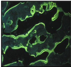 Bone surface after double tetracycline labeling in order to study bone formation rate.